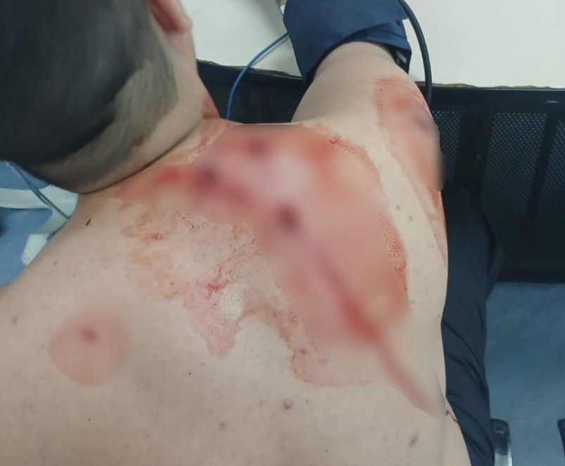 foto Not&iacute;cia Volta Redonda